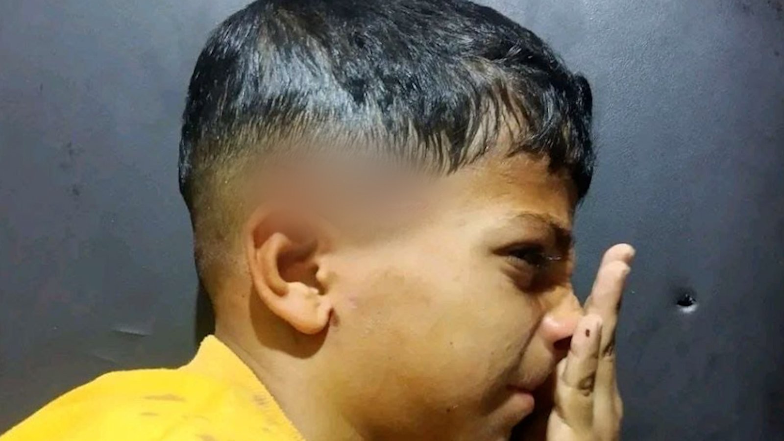 Palestinian child survives Israeli gunshot to the head